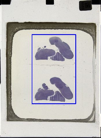 Media type: image; Special Collections 3043   shows specimen_part histological serial section;